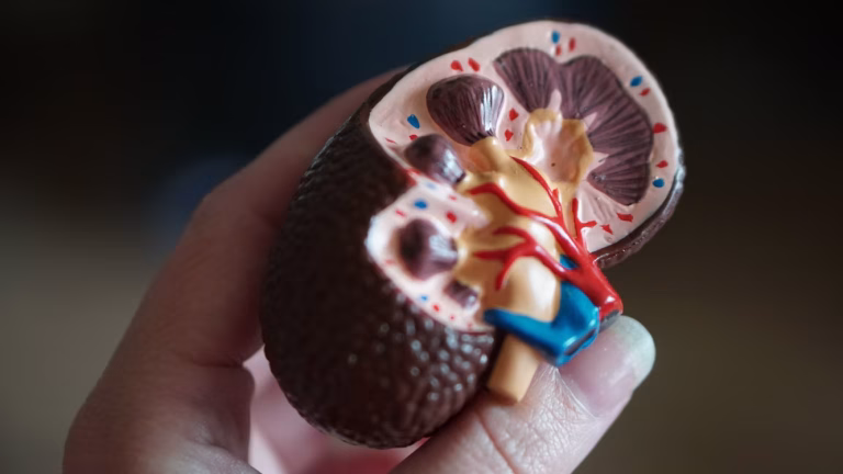 Kidney Stone Diet: How to Prevent Kidney Stones 9 Kidney Stone Diet